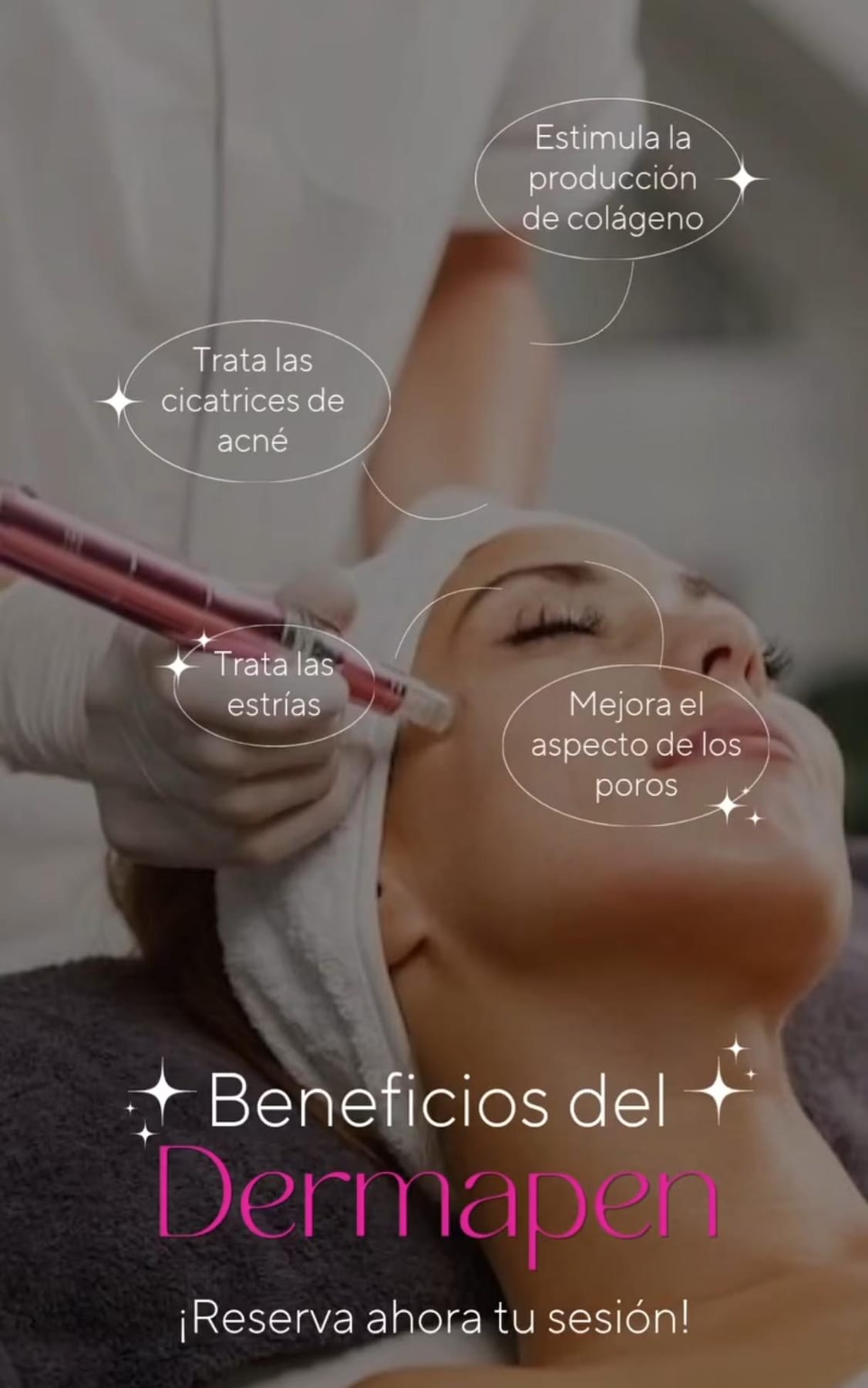 Beneficios del tratamiento Dermapen